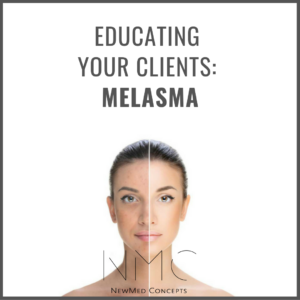 Educating Your Clients: Melasma