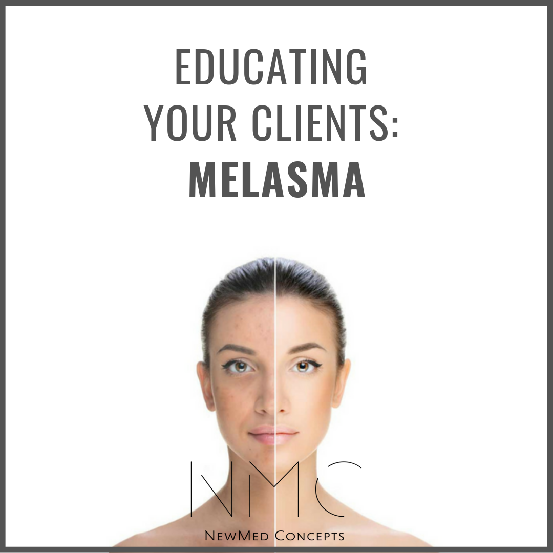 You are currently viewing Educating Your Clients: Melasma