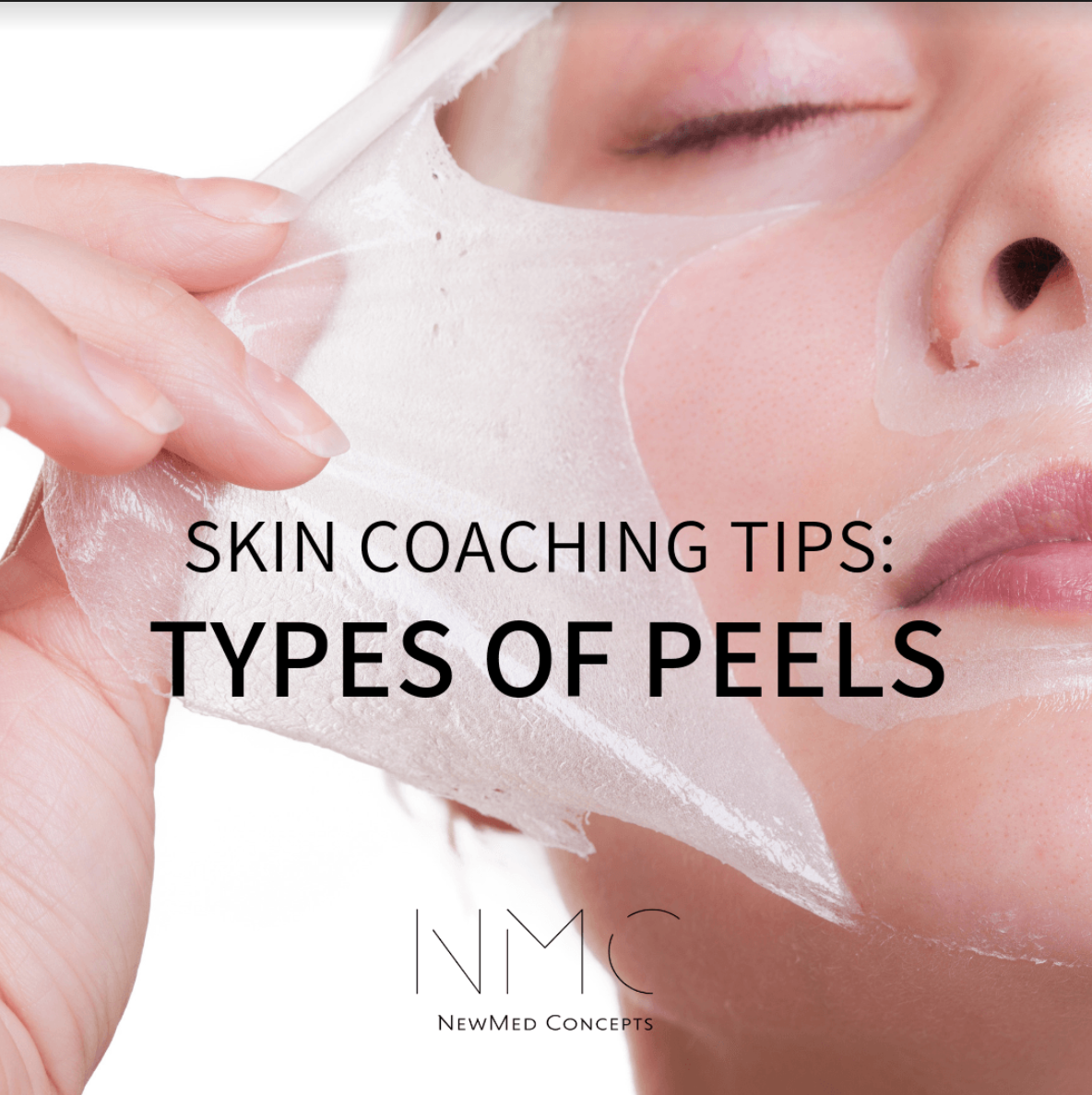 You are currently viewing Skin Coaching Tips: Types of Peels 