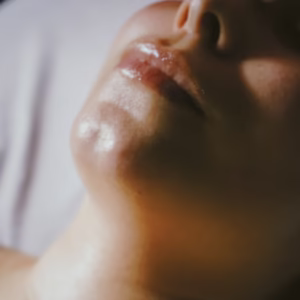 MasterClass: Peels and Microneedling with Gayle